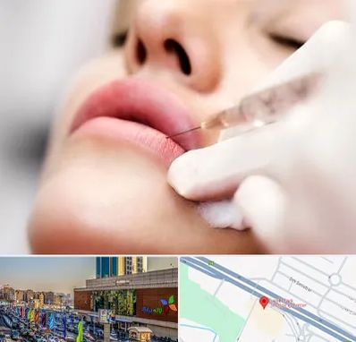 کلینیک تزریق ژل لب در لاله پارک تبریز