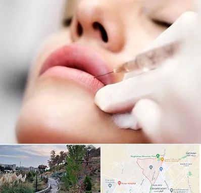 کلینیک تزریق ژل لب در باغستان کرج