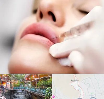 کلینیک تزریق ژل لب در درکه
