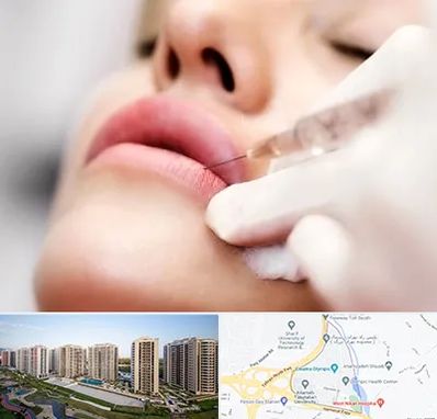 کلینیک تزریق ژل لب در المپیک