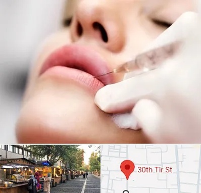 کلینیک تزریق ژل لب در سی تیر