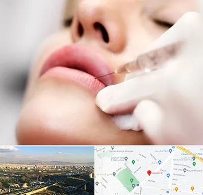 کلینیک تزریق ژل لب در هنگام