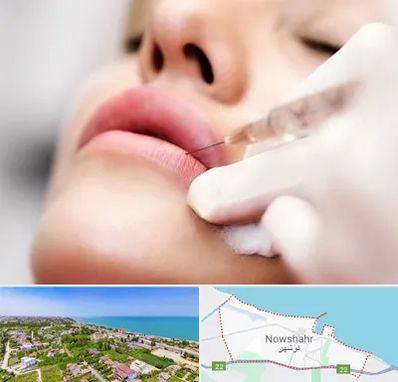 کلینیک تزریق ژل لب در نوشهر