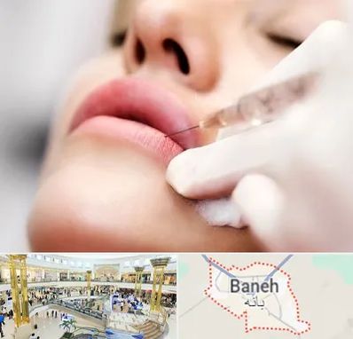 کلینیک تزریق ژل لب در بانه