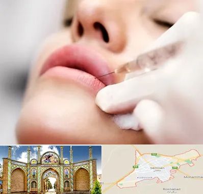 کلینیک تزریق ژل لب در سمنان