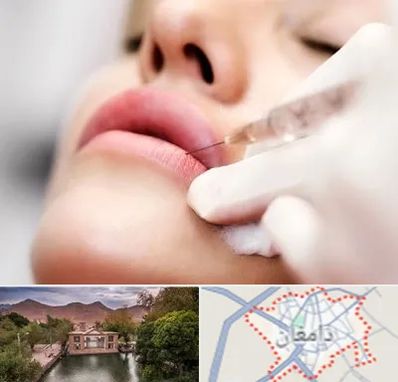 کلینیک تزریق ژل لب در دامغان