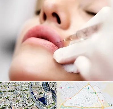 کلینیک تزریق ژل لب در قاسم آباد مشهد