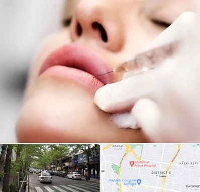 کلینیک تزریق ژل لب در ظفر