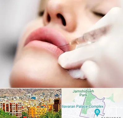 کلینیک تزریق ژل لب در نیاوران