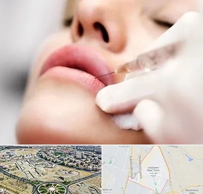 کلینیک تزریق ژل لب در اندیشه