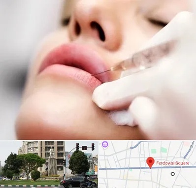 کلینیک تزریق ژل لب در میدان فردوسی تهران