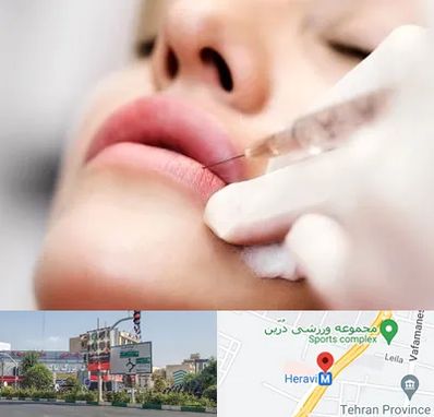 کلینیک تزریق ژل لب در هروی