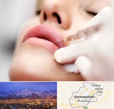 کلینیک تزریق ژل لب در کرمانشاه