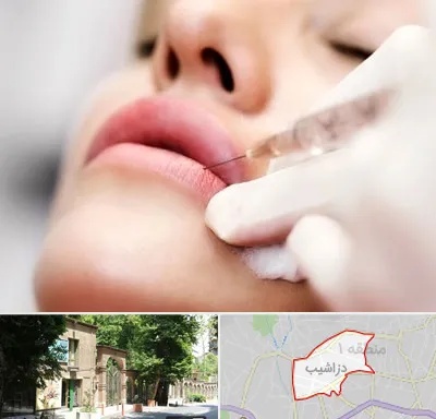 کلینیک تزریق ژل لب در دزاشیب