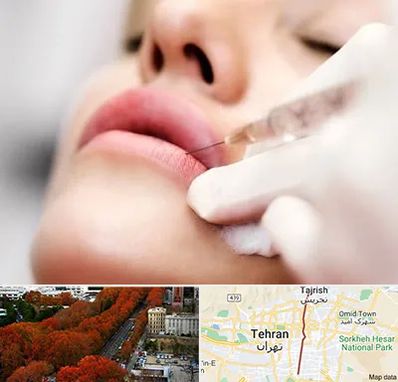 کلینیک تزریق ژل لب در ولیعصر