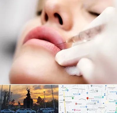 کلینیک تزریق ژل لب در میدان حر