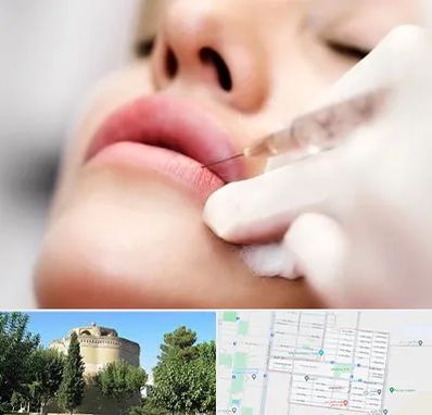 کلینیک تزریق ژل لب در مرداویج اصفهان