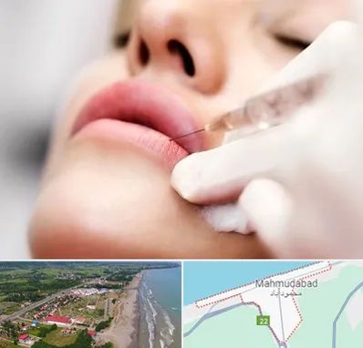 کلینیک تزریق ژل لب در محمودآباد