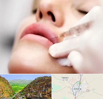 کلینیک تزریق ژل لب در کامیاران