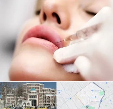 کلینیک تزریق ژل لب در طلاب مشهد
