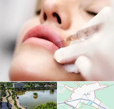 کلینیک تزریق ژل لب در لنگرود