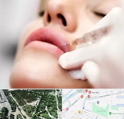 کلینیک تزریق ژل لب در سالاریه قم