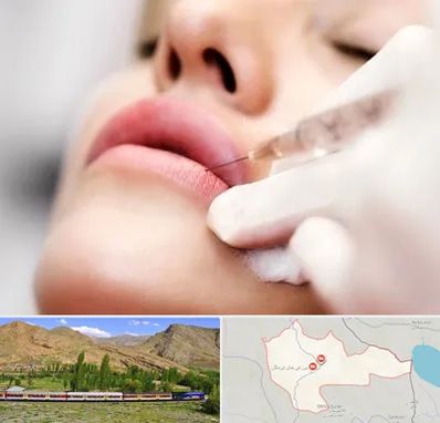 کلینیک تزریق ژل لب در خاش