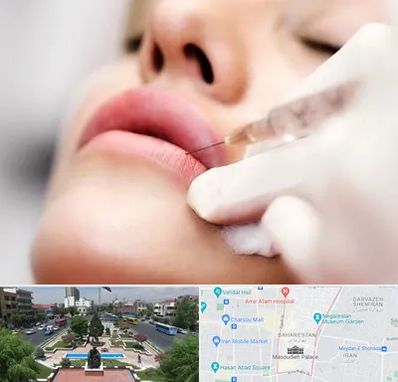 کلینیک تزریق ژل لب در بهارستان