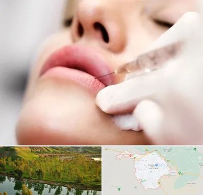 کلینیک تزریق ژل لب در بهبهان