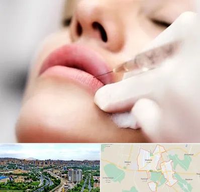 کلینیک تزریق ژل لب در شهریار