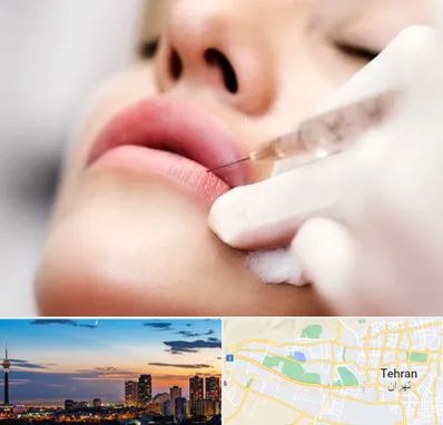 کلینیک تزریق ژل لب در غرب تهران