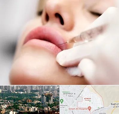 کلینیک تزریق ژل لب در عظیمیه کرج