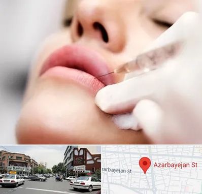 کلینیک تزریق ژل لب در خیابان آذربایجان
