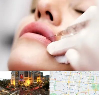 کلینیک تزریق ژل لب در جنت آباد تهران