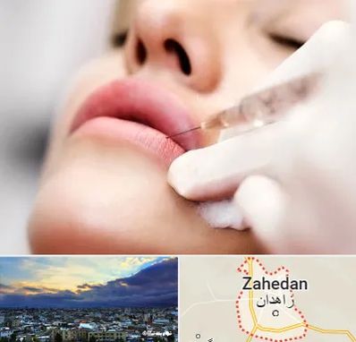 کلینیک تزریق ژل لب در زاهدان