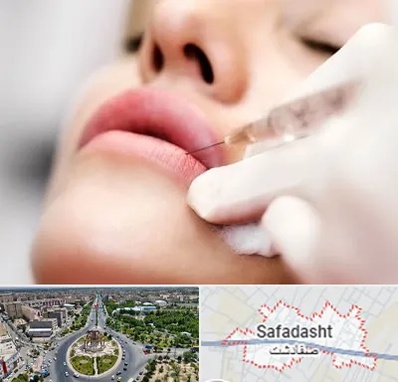 کلینیک تزریق ژل لب در صفادشت