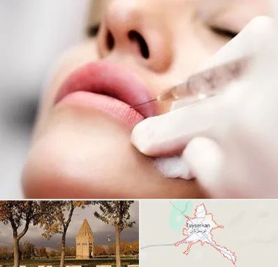کلینیک تزریق ژل لب در تویسرکان