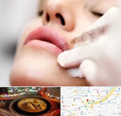 کلینیک تزریق ژل لب در میدان ولیعصر