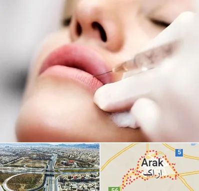 کلینیک تزریق ژل لب در اراک