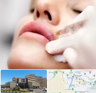 کلینیک تزریق ژل لب در صیاد شیرازی مشهد