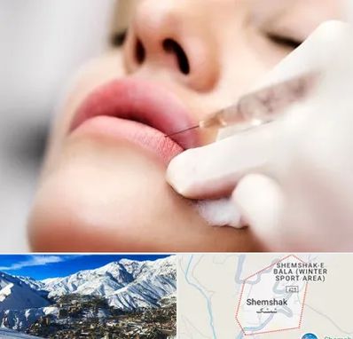 کلینیک تزریق ژل لب در شمشک