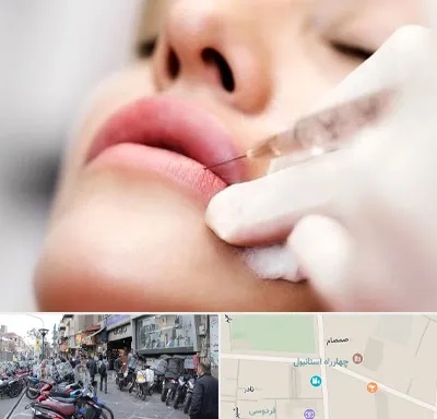 کلینیک تزریق ژل لب در چهارراه استانبول