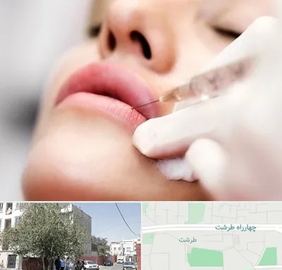 کلینیک تزریق ژل لب در طرشت