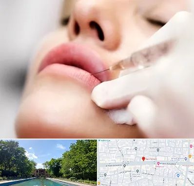 کلینیک تزریق ژل لب در هشت بهشت اصفهان