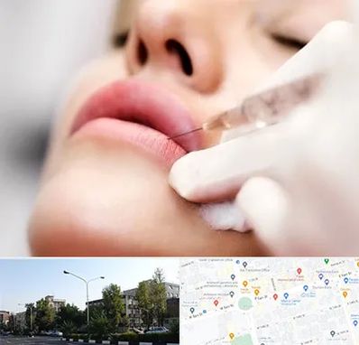 کلینیک تزریق ژل لب در میدان کاج