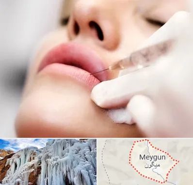 کلینیک تزریق ژل لب در میگون