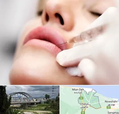 کلینیک تزریق ژل لب در چالوس