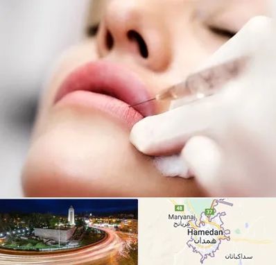 کلینیک تزریق ژل لب در همدان