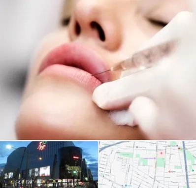 کلینیک تزریق ژل لب در بلوار اباذر