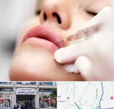 کلینیک تزریق ژل لب در ایران زمین
